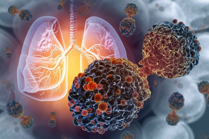 como-funciona-1a-vacina-do-mundo-para-prevencao-do-cancer-de-pulmao