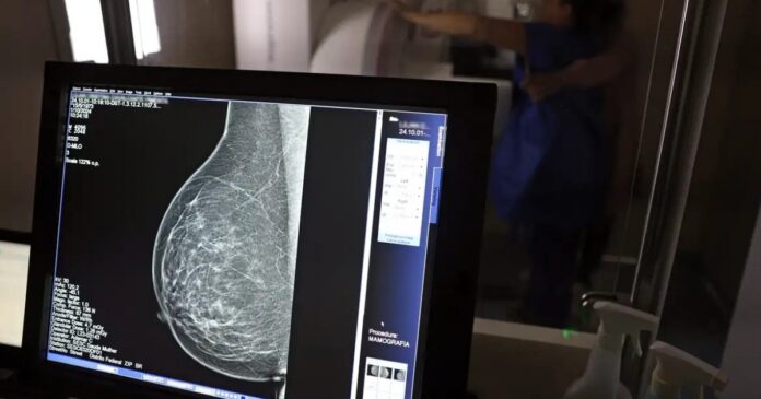 governo-federal-sanciona-lei-que-assegura-reabilitacao-fisica-a-pacientes-de-cancer-de-mama