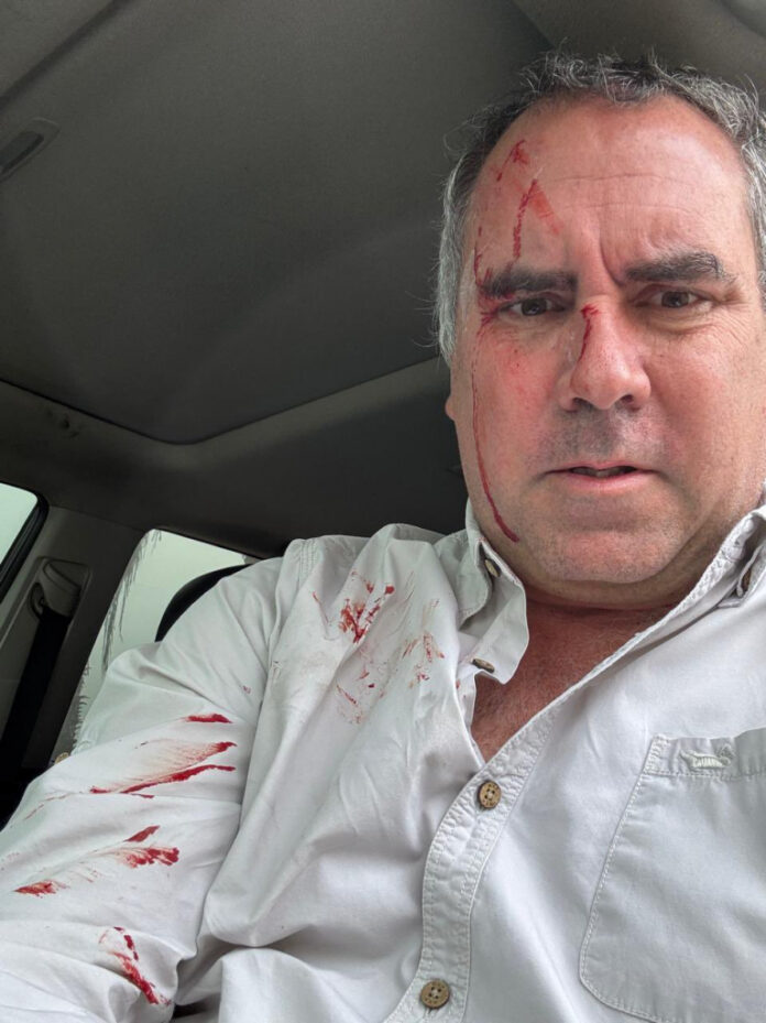 carro-de-pre-candidato-a-presidente-do-peru-e-alvo-de-tiros