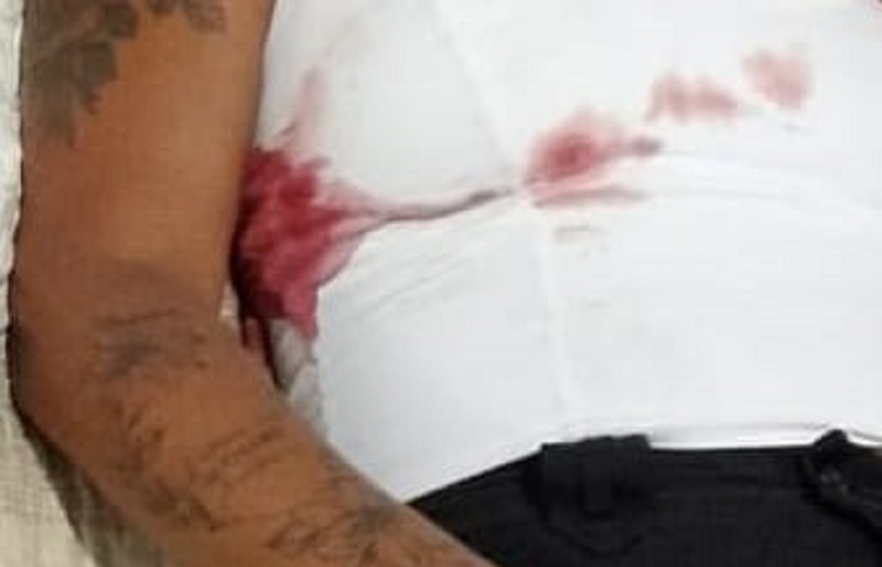 tres-pessoas-feridas-em-ataque-a-pousada-no-corumbau;-vitimas-nao-sabem-quem-e-o-responsavel-e-o-motivo