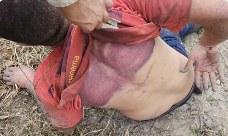 motorista-por-aplicativo-e-resgatado-apos-ser-sequestrado-e-torturado-por-traficantes-no-extremo-sul-da-bahia