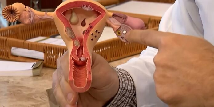 chamada-publica-para-pesquisas-sobre-endometriose-e-aberta