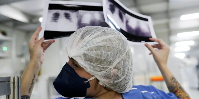 cancer-de-pulmao:-atraso-no-diagnostico-reduz-as-chances-de-cura