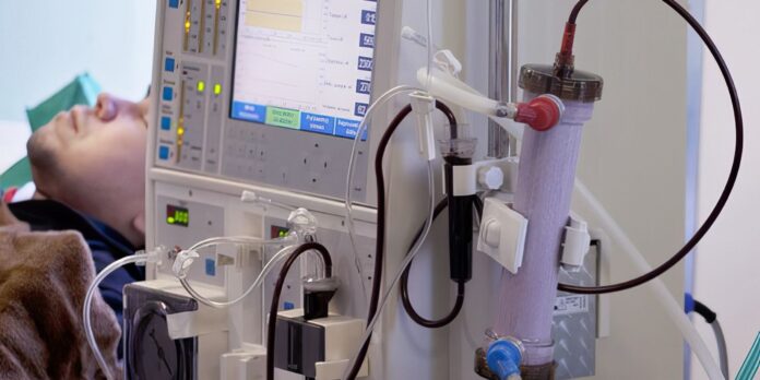 brasil-registra-subdiagnostico-da-doenca-renal-cronica,-aponta-estudo