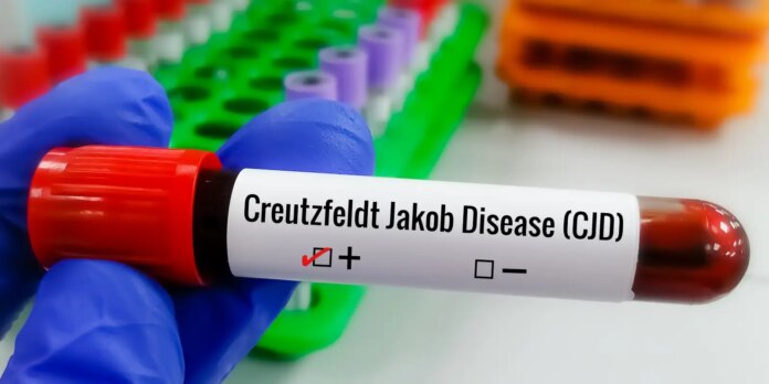doenca-de-creutzfeldt-jakob:-piloto-lito-souza-tem-diagnostico-confirmado