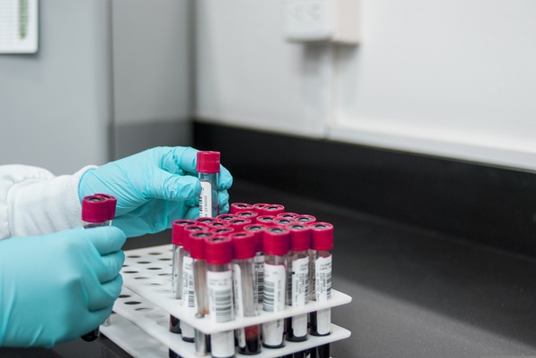 tst-condena-empresa-por-coleta-de-sangue-de-empregada-desmaiada