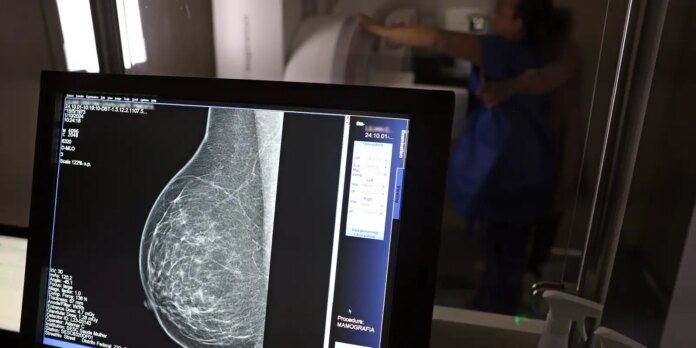 plano-de-saude-passa-a-cobrir-mamografia-digital-para-todas-as-idades