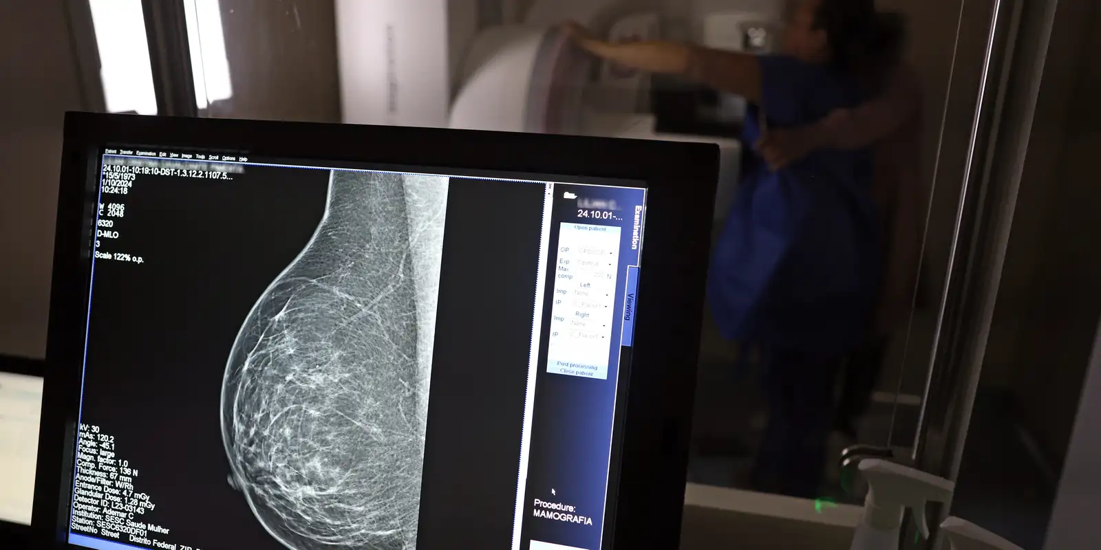 Médicos apresentam guia para evitar recusa de mamografia digital
